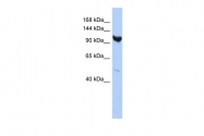 ARP55626_P050 - ARMC3