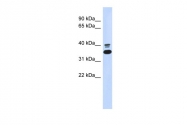 ARP55651_P050 - Epoxide hydrolase 4 / EPHX4