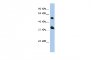 ARP55781_P050 - Tetraspanin-33 / TSPAN33