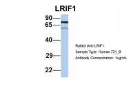 ARP56174_P050 - C1orf103
