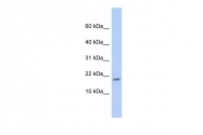 ARP56185_P050 - 14-3-3 protein sigma / SFN