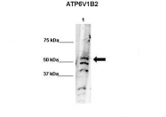 ARP56328_P050 - ATP6V1B2