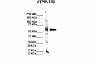 ARP56329_P050 - ATP6V1B2
