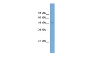 ARP56366_P050 - Neuronal pentraxin-2