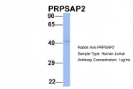 ARP56445_P050 - PRPSAP2