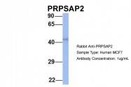 ARP56445_P050 - PRPSAP2