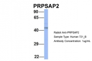 ARP56445_P050 - PRPSAP2