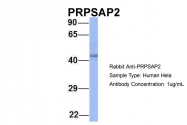 ARP56445_P050 - PRPSAP2