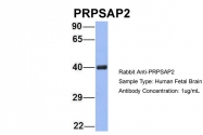 ARP56445_P050 - PRPSAP2