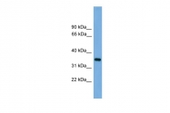 ARP56447_P050 - Trypsin-3 / PRSS3