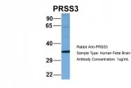 ARP56447_P050 - Trypsin-3 / PRSS3