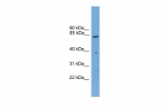 ARP56480_P050 - PSMD3