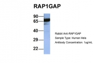 ARP56511_P050 - RAP1GAP