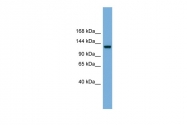 ARP56515_P050 - RASGRF1