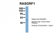 ARP56515_P050 - RASGRF1