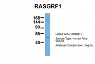 ARP56515_P050 - RASGRF1