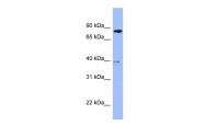 ARP56519_P050 - Radixin / RDX