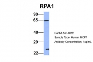 ARP56526_P050 - RPA1
