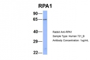 ARP56526_P050 - RPA1