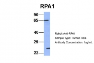 ARP56526_P050 - RPA1
