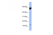 ARP56533_P050 - S100A9 / Calgranulin-B / MRP14