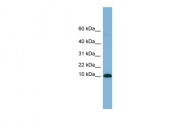ARP56555_P050 - Beta-2-microglobulin