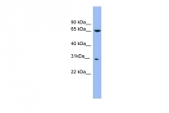 ARP56579_P050 - Complex I subunit NDUFS3