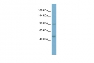 ARP56587_P050 - Plakophilin-2