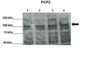 ARP56587_P050 - Plakophilin-2