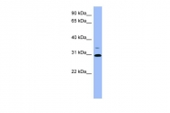 ARP56588_P050 - Phosphoserine phosphatase