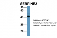 ARP56684_P050 - SERPINE2