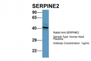 ARP56684_P050 - SERPINE2