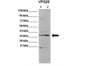 ARP56850_P050 - VPS28