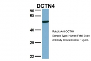 ARP56856_P050 - Dynactin subunit 4