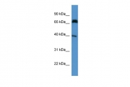 ARP56892_P050 - DCDC2