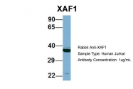 ARP56969_P050 - XAF1