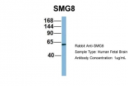 ARP57129_P050 - ABC2 / SMG8