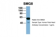 ARP57129_P050 - ABC2 / SMG8