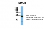 ARP57129_P050 - ABC2 / SMG8