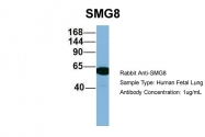 ARP57129_P050 - ABC2 / SMG8