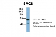 ARP57129_P050 - ABC2 / SMG8
