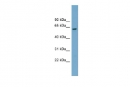 ARP57167_P050 - CNDP2