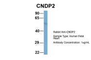 ARP57168_P050 - CNDP2