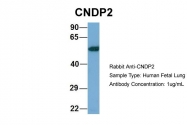 ARP57168_P050 - CNDP2