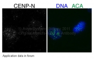 ARP57258_P050 - CENP-N