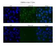 ARP57258_P050 - CENP-N