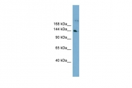 ARP57449_P050 - WDR35