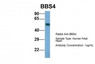 ARP57695_P050 - BBS4