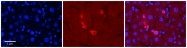 ARP57731_P050 - MAPK7 / ERK5