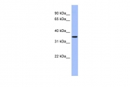 ARP57765_P050 - Protein phosphatase 1A / PPM1A